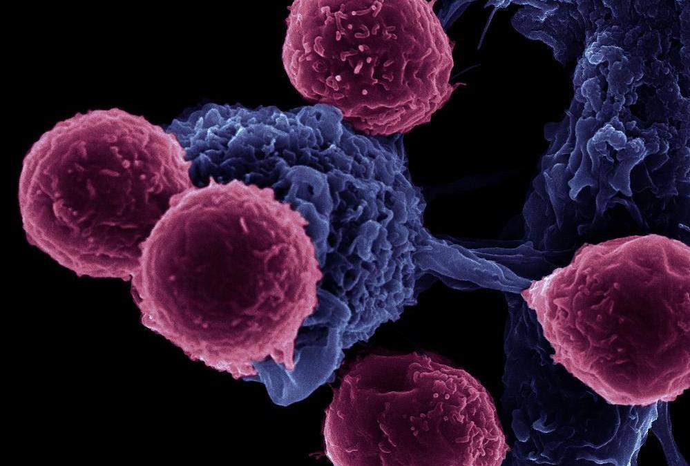 Immune Senescence – or how your aging immune cells put you at risk