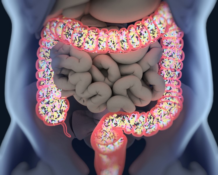 Leaky Gut & Your Microbiome